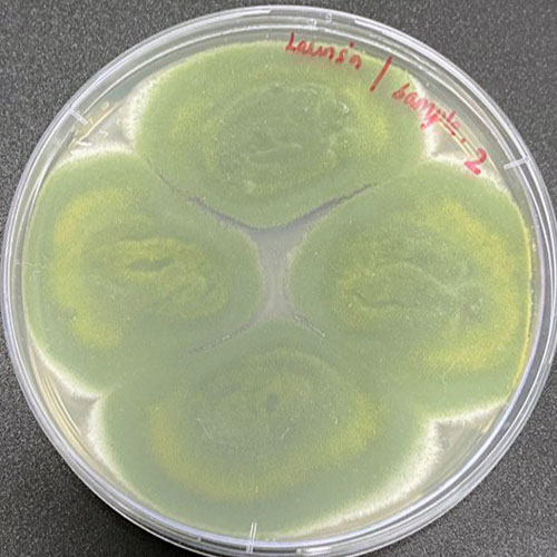 aspergillus mold 2