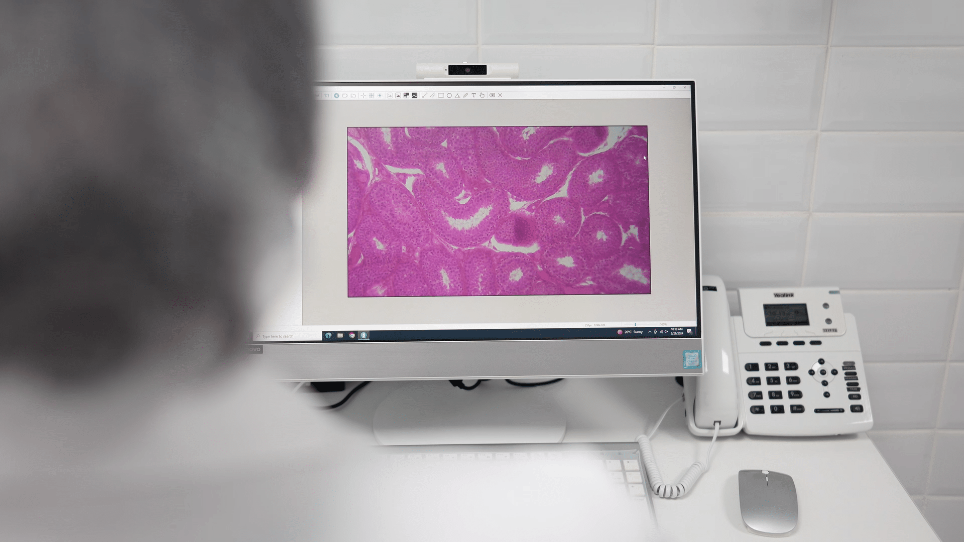 Black Mold Health Symptoms in Children UAE - Child experiencing respiratory symptoms from mold exposure in Dubai home